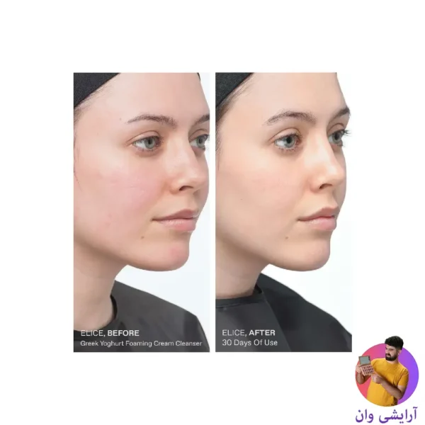 acm-depiwhite-advanced-antispotcream-1